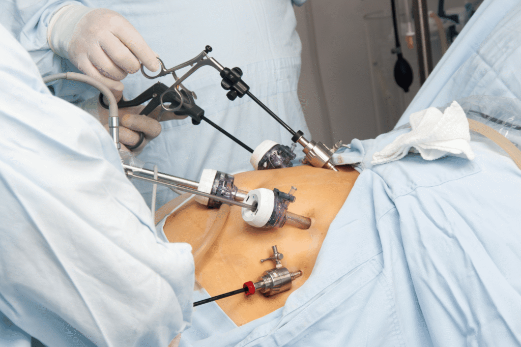 General & Laparoscopic Surgery​